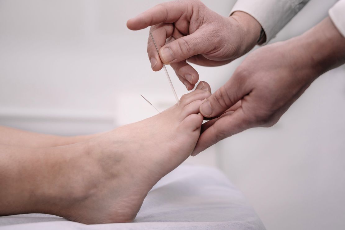 Diabetic Foot and Chronic Foot Wounds: Treatment Methods and Precautions